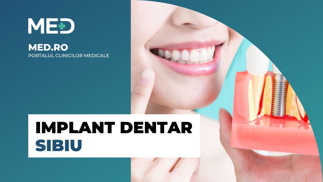 Implant dentar Sibiu Top 5 Clinici Prețuri Programare Online