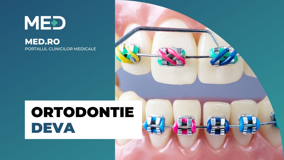 Ortodontie Deva Top 5 Clinici Prețuri Programare Online