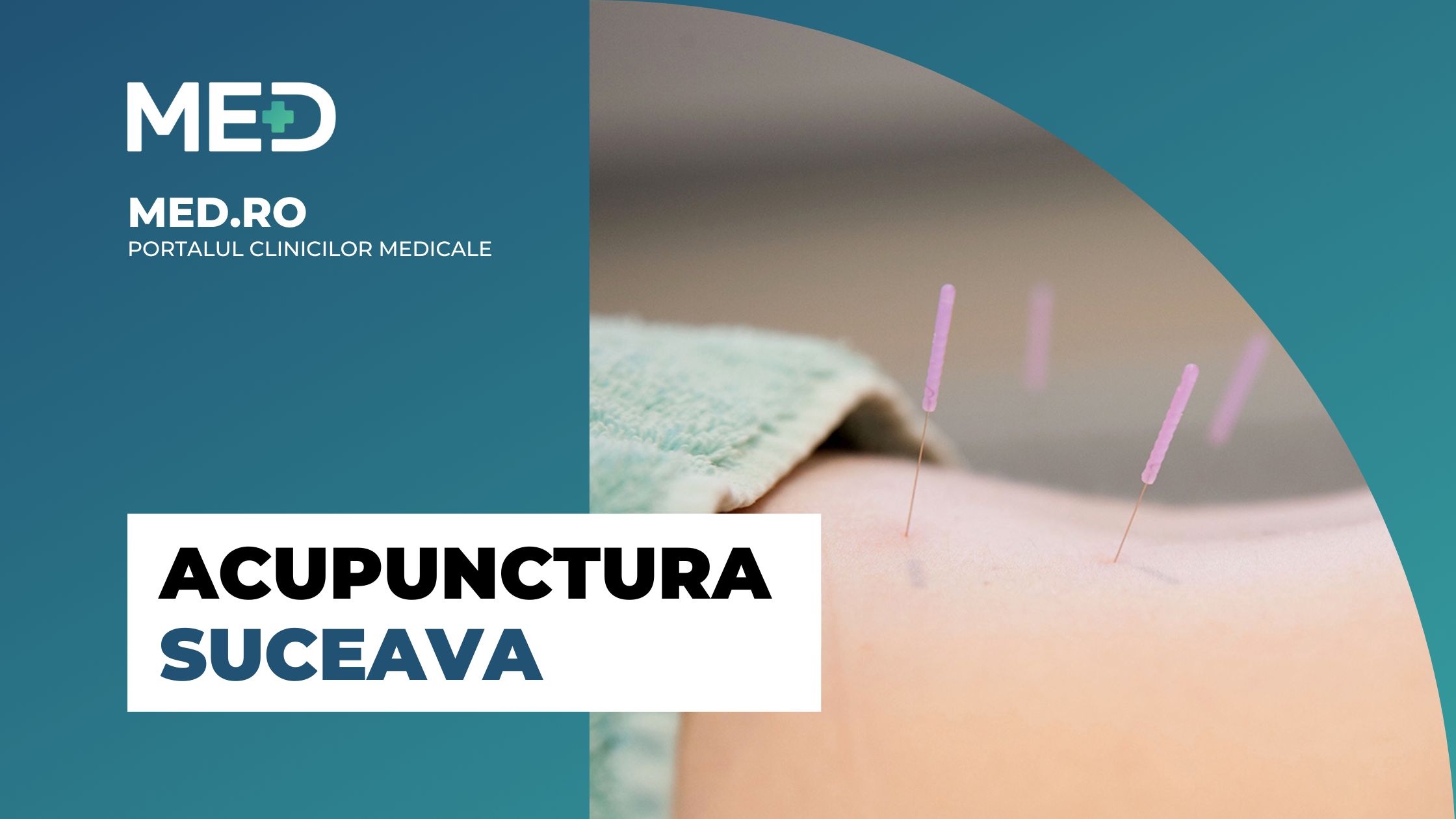 Acupunctura Suceava Clinica Verificata Med Ro