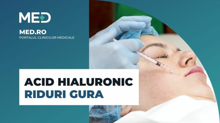 Acid Hialuronic riduri gura