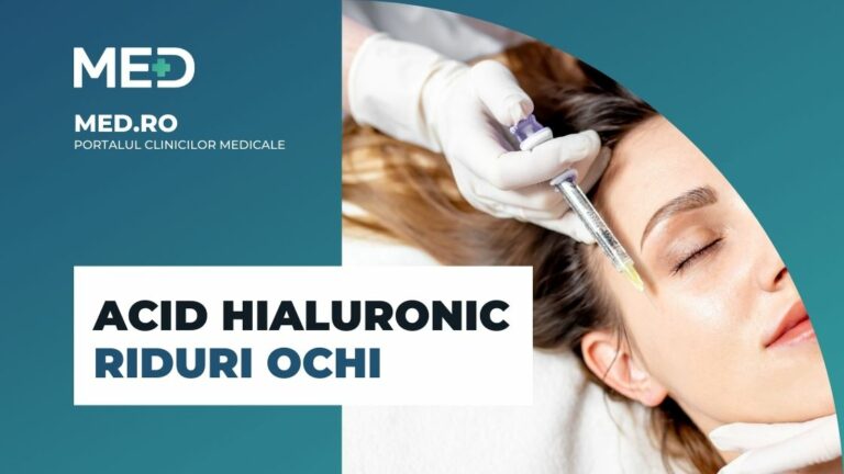 Acid Hialuronic Riduri Ochi