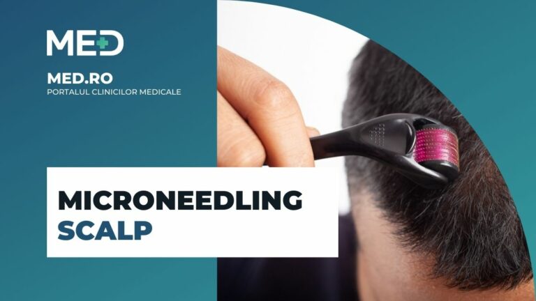 Microneedling scalp