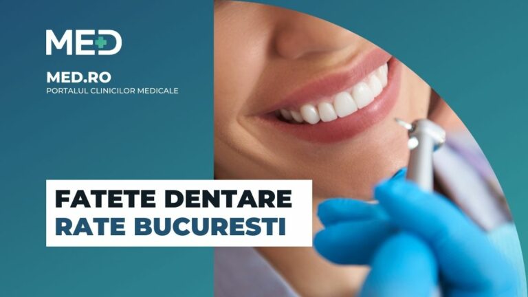 Fatete dentare rate Bucuresti