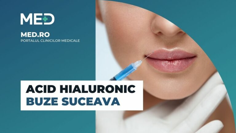 Acid hialuronic buze Suceava