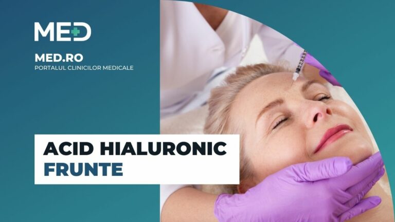 Acid hialuronic frunte