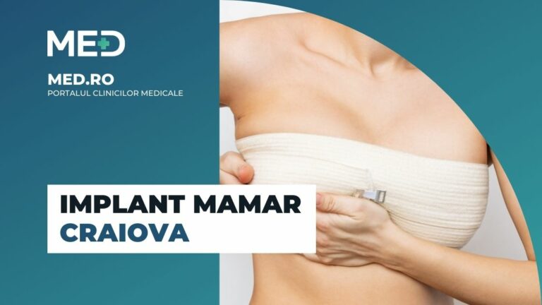 Implant mamar Craiova