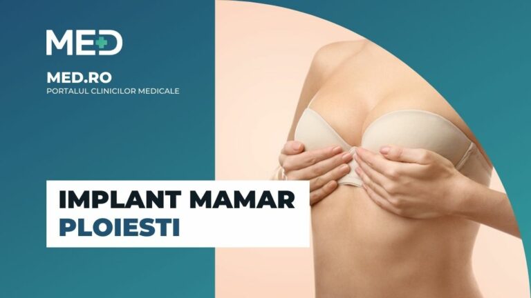 Implant mamar Ploiesti