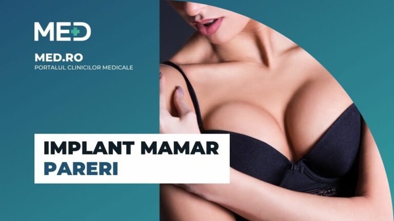 Implant mamar pareri