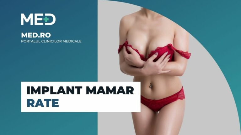 Implant mamar rate