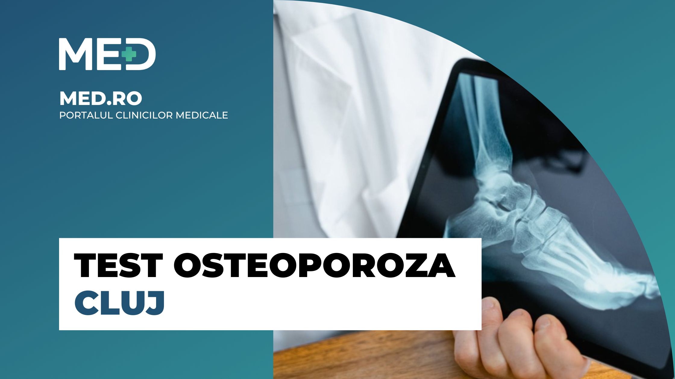 Test Osteoporoza Cluj - Top 3 Clinici verificate - Med.ro