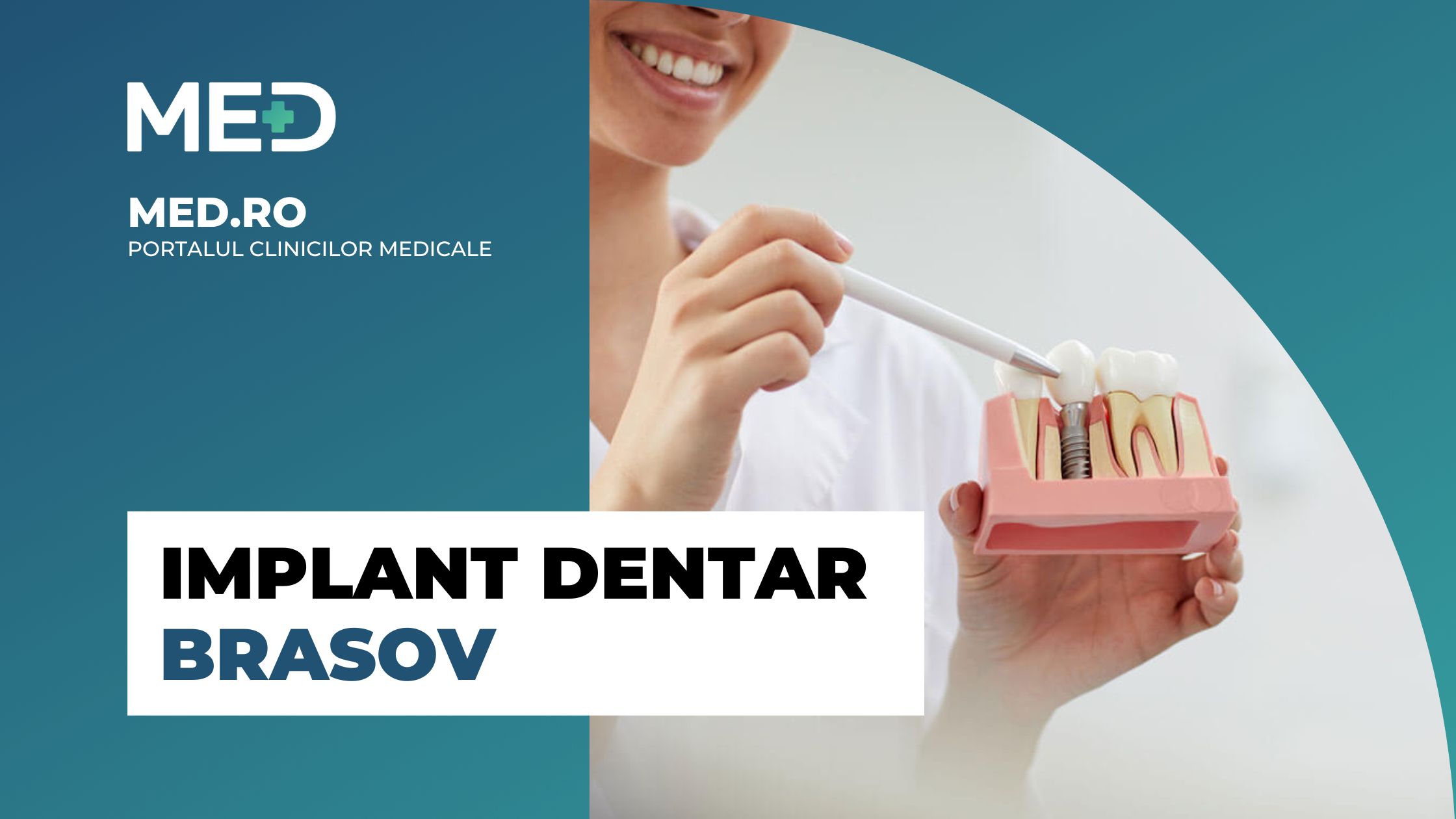 Implant Dentar Brasov Top Clinici Verificate Med Ro