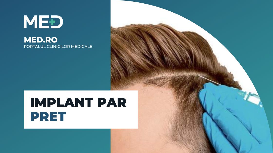 Implant Păr Preț – Costul Real & Cea mai buna clinica din Romania