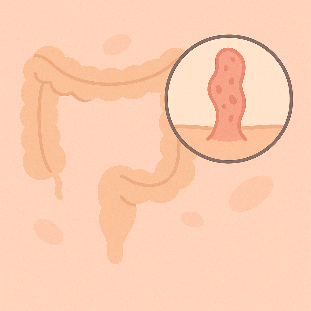 sistem-digestiv-adenom